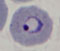 卵形マラリア 輪状体