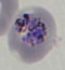 卵形マラリア 分裂体